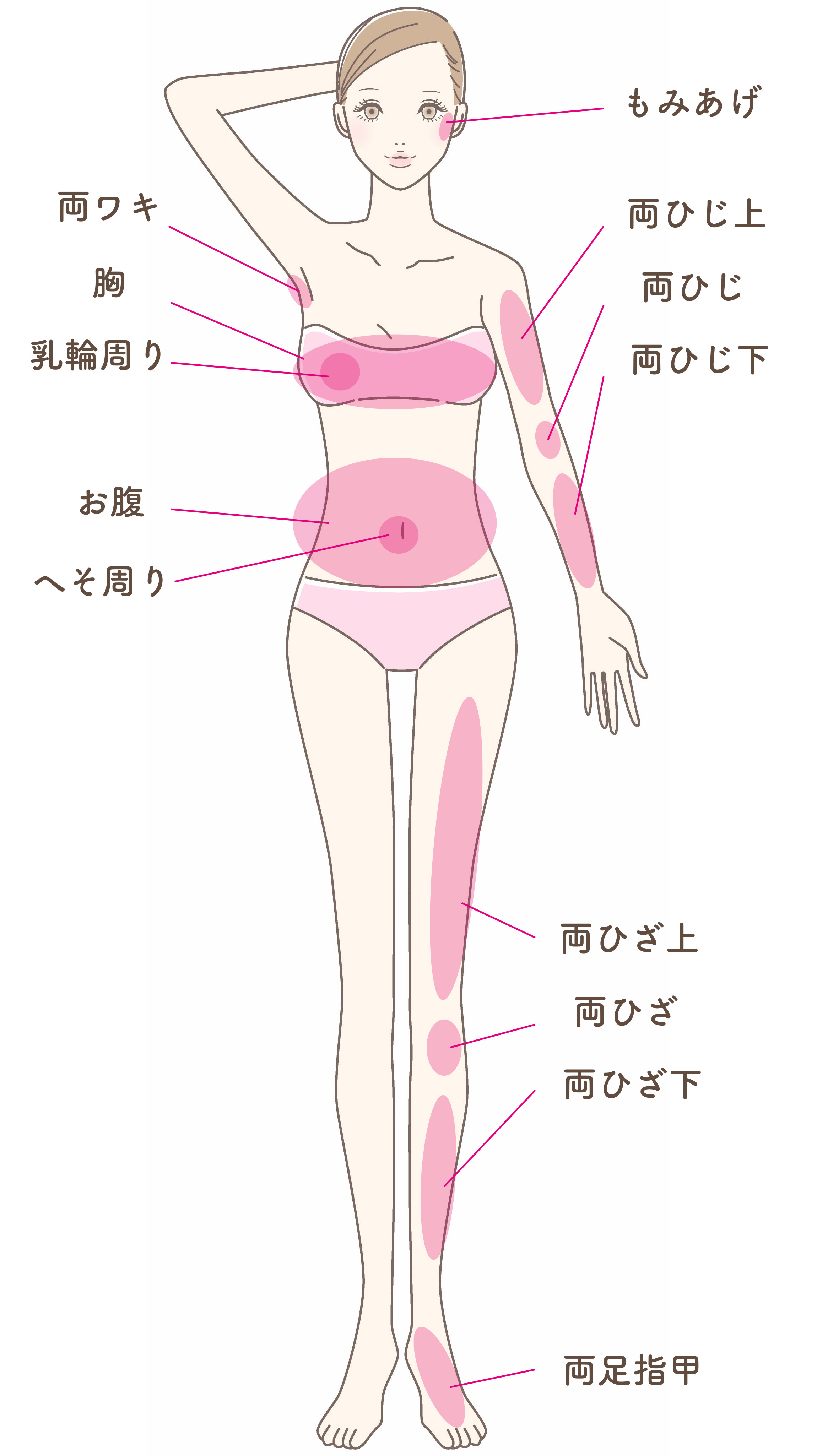 女性脱毛部位１