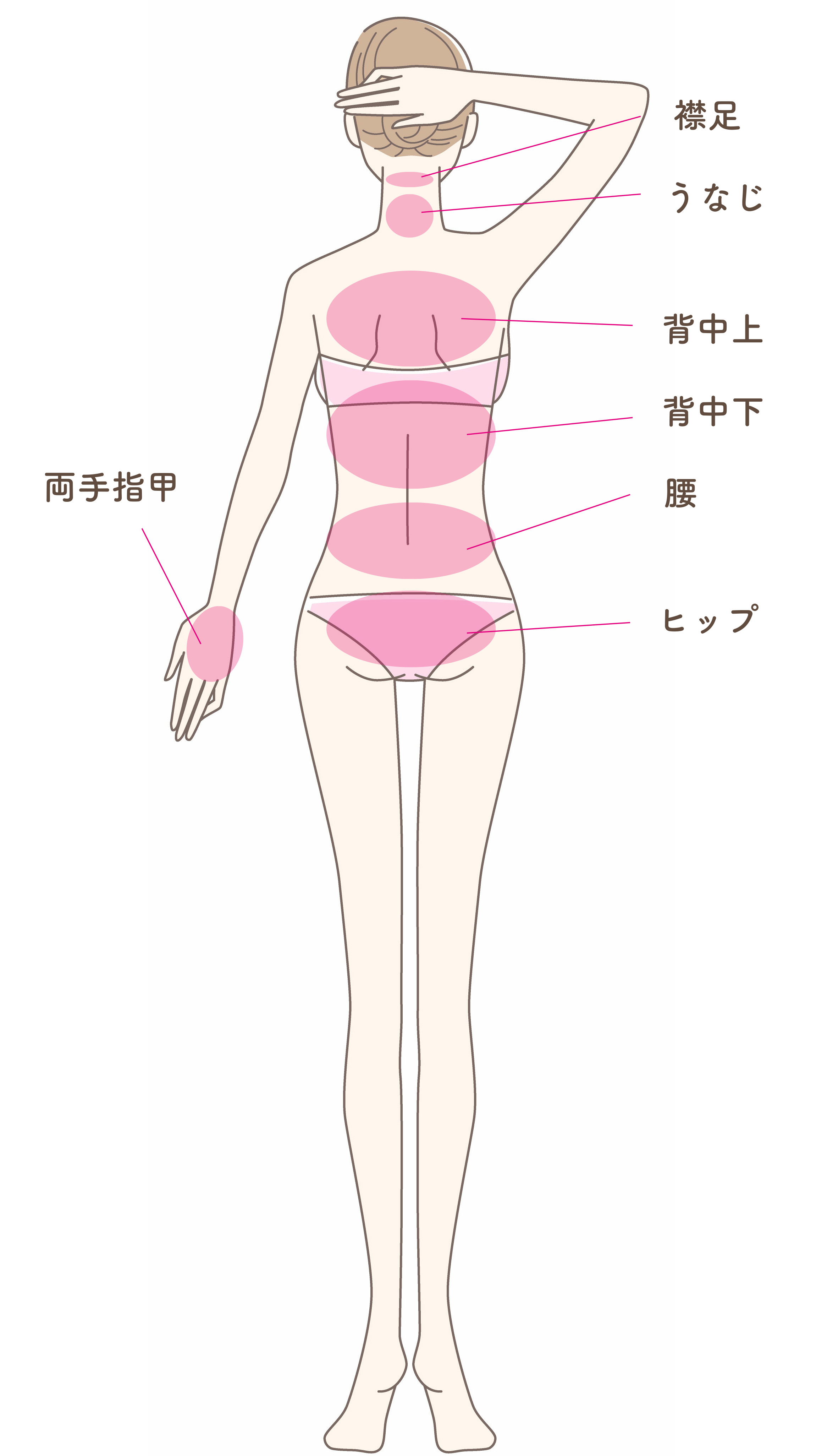 女性脱毛部位２